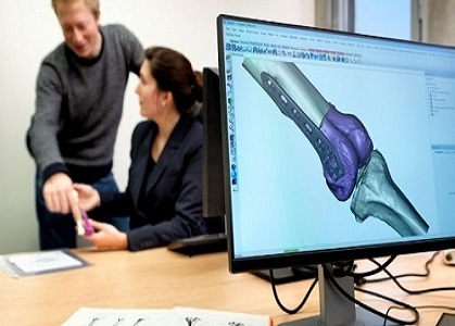 High-precision bionics design and mechanical prosthetic component modeling
